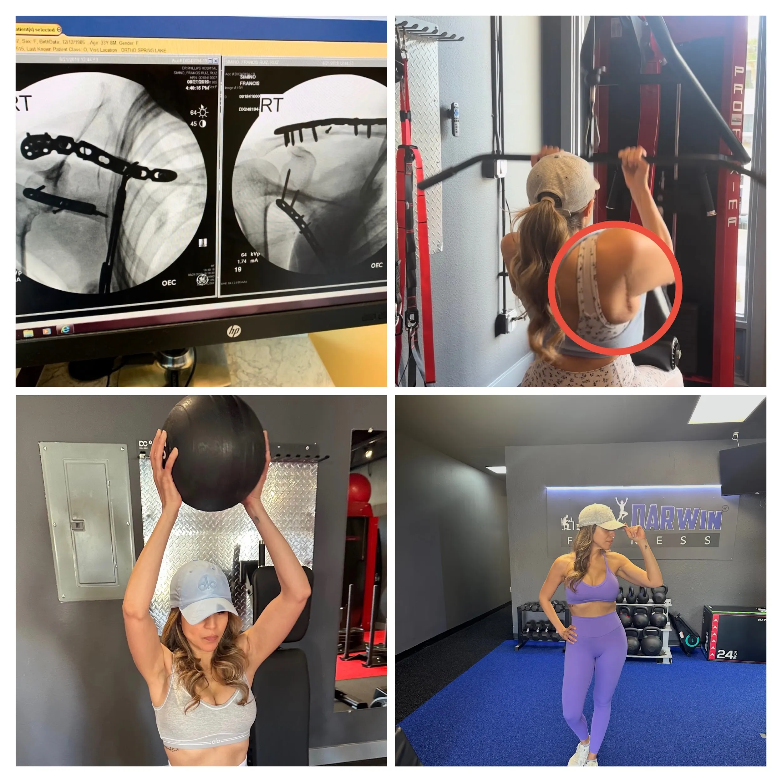 francis rebuilding strength after a traumatic injury and frozen shoulder at darwin fitness